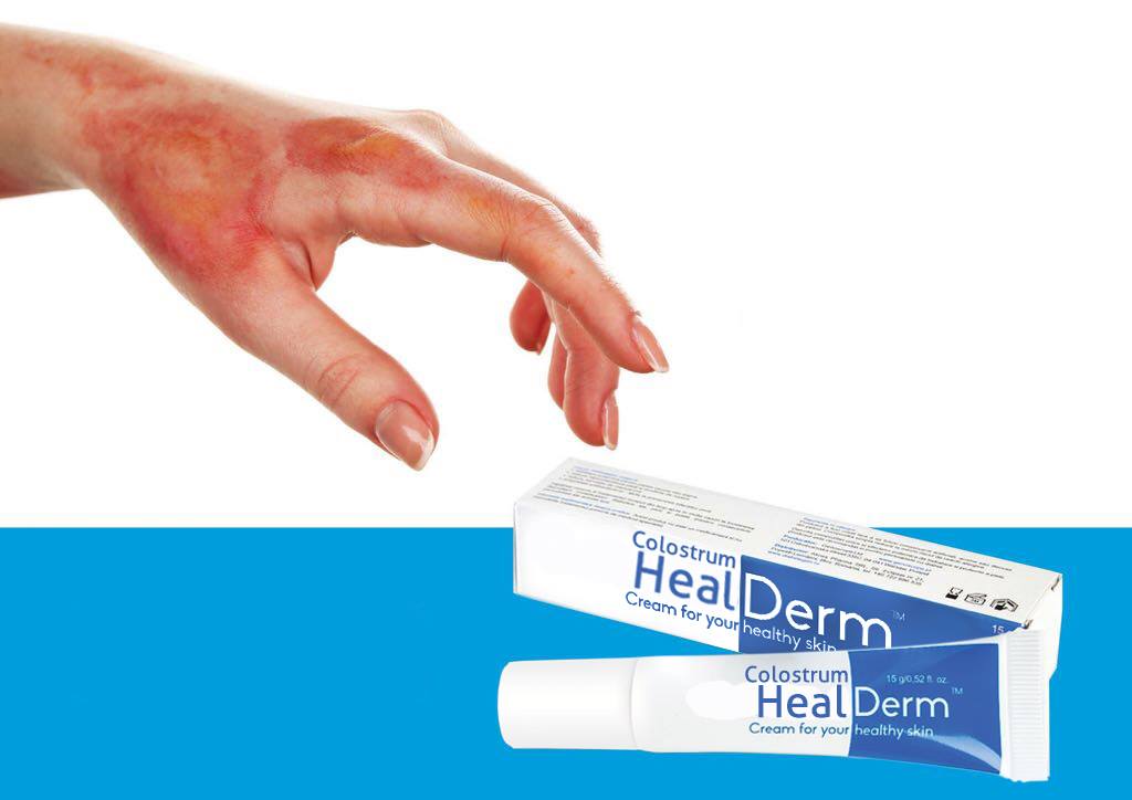 HealdDerm, 15G - Aids in Tissue Regeneration